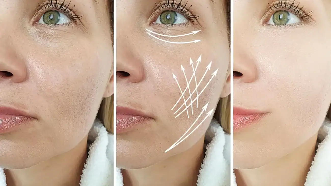 Can One Treatment Really Tackle More Than One Skin Concern Liverpool?