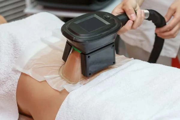 Image of person having fat freezing treatment to help weight gain Liverpool