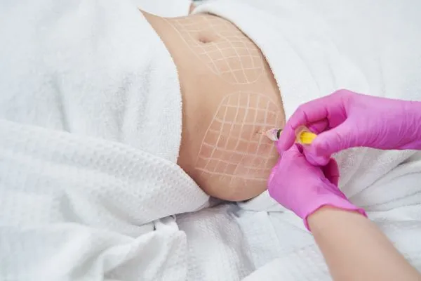 image of fat dissolving injections on love handles to help combat weight gain Liverpool