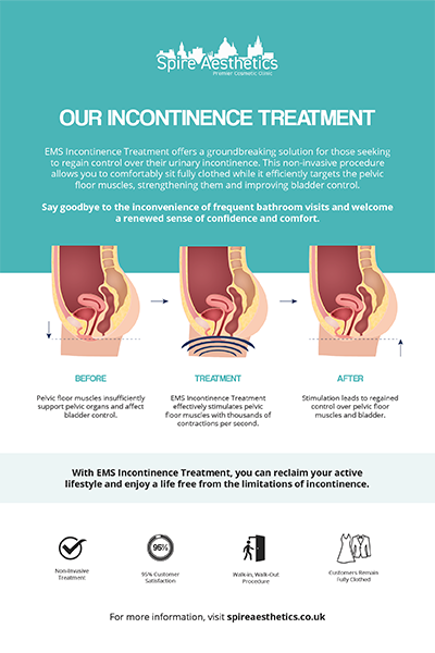 image to show how EMS treatment works for female urinary incontinence Liverpool