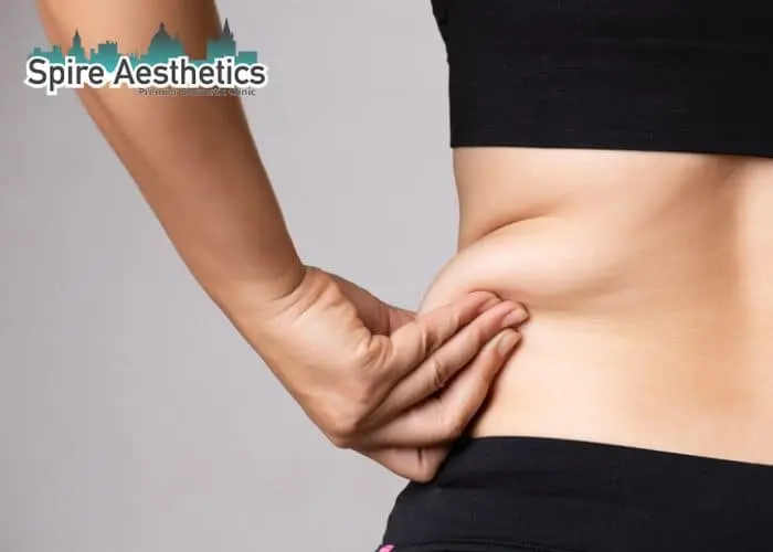Image of woman pinching fat on their hips Liverpool. Fat Freezing treatment