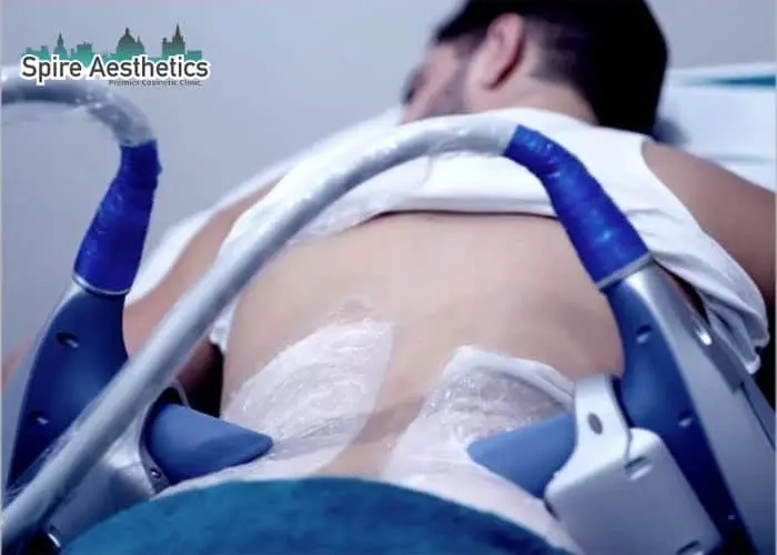 Man having fat freezing treatment done on love handles before a competitions Liverpool to create a sculpted look.
