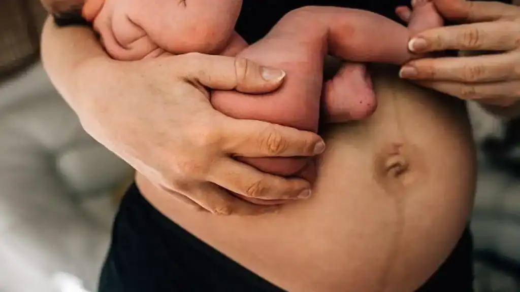 Why Is My Stomach Still Big After Pregnancy Liverpool?